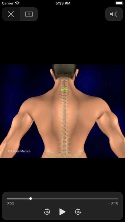 Back and Spinal cord screenshot-4