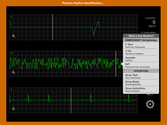 Screenshot #5 pour arrhythmia