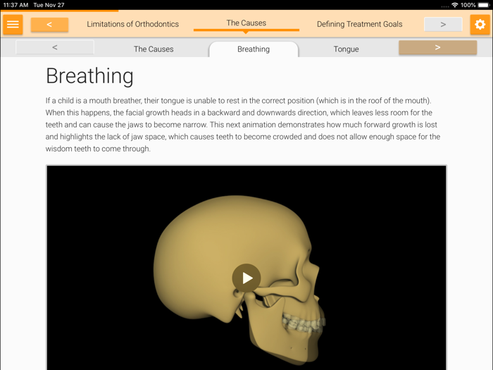 Myobrace Consultation
