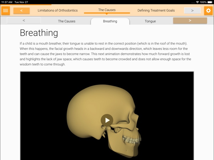 Myobrace Consultation screenshot-3