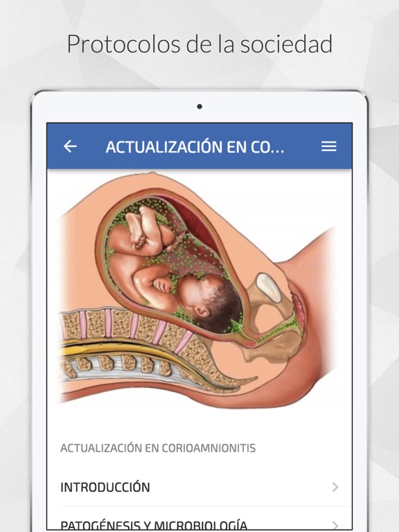 Screenshot #6 pour SAGO