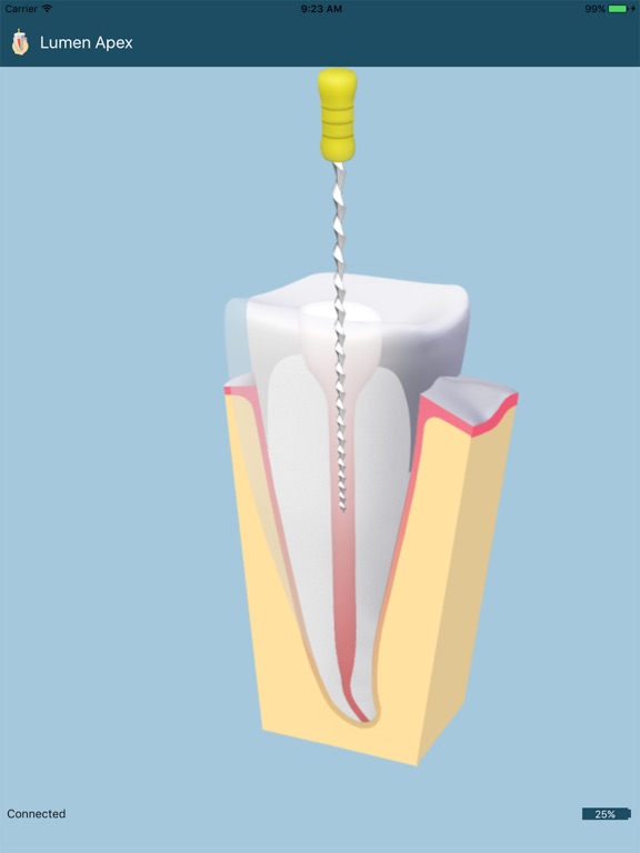 Screenshot #4 pour Lumen Apex