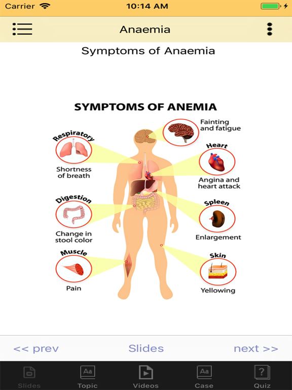 Anaemia (offline) iPad screenshot