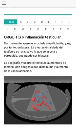 Ecografía Escrotal(圖4)-速報App