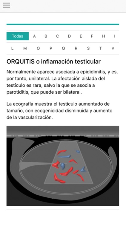 Ecografía Escrotal screenshot-3