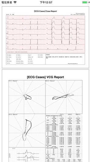 ECG - 海量心電圖案例和診斷詳解(圖5)-速報App