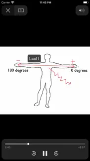 ecgsource iphone resimleri 4
