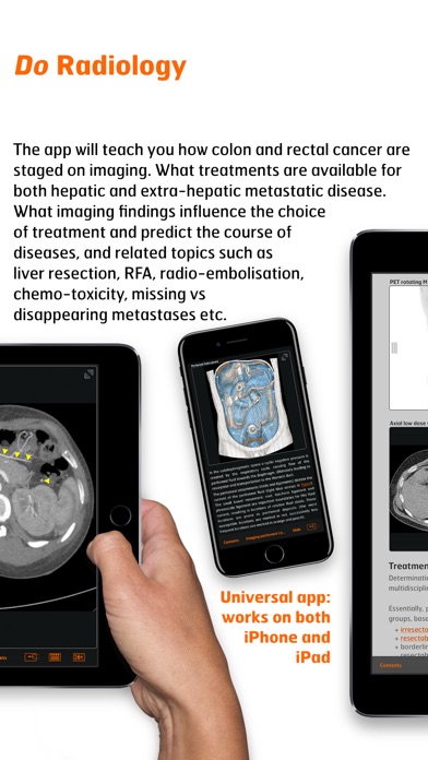 Radiology - CRC Staging Atlas screenshot 3