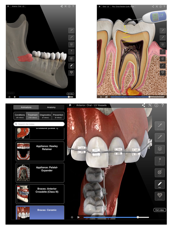 Dental Patient Educationのおすすめ画像2