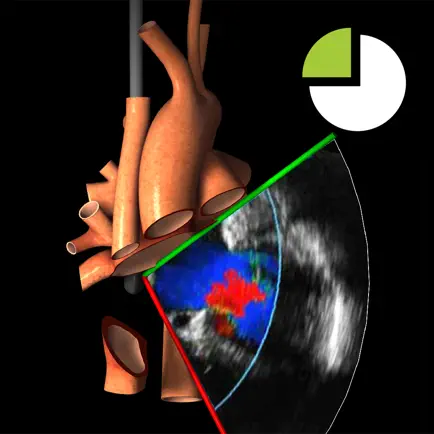 TEE Colour Doppler Cheats