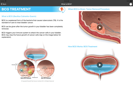 Screenshot #6 pour BCG Treatment