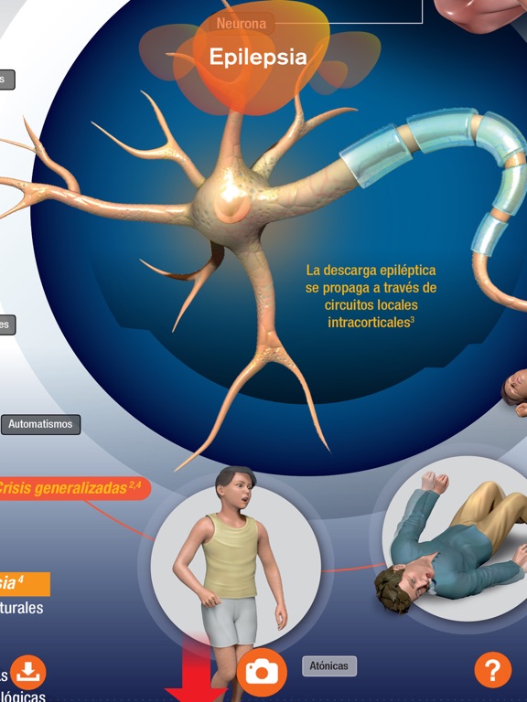 Screenshot #5 pour GSK Epilepsia