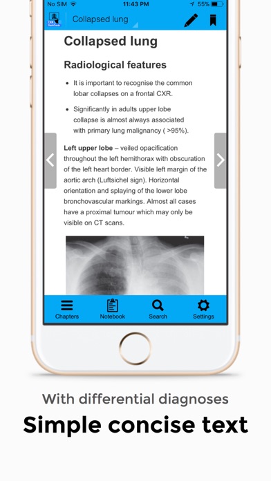 Chest X-Ray FlashCardsのおすすめ画像2