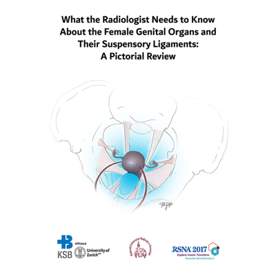 Female pelvis MRI RSNA