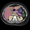 Radiology CT Viewer - Lieu Duong