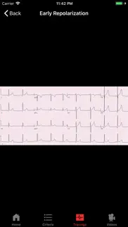 ecgsource iphone resimleri 2