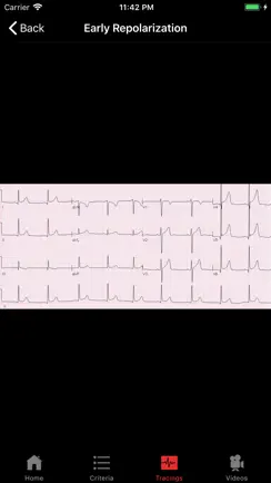 ECGsource iPhone image 2