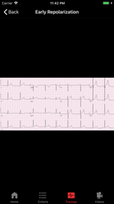 ECGsource screenshot