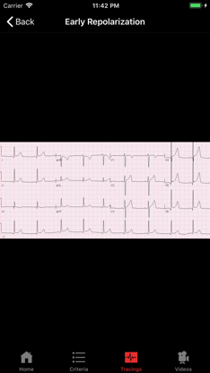 ECGsource screenshot 2