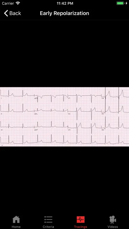 ECGsource screenshot 2 of 5