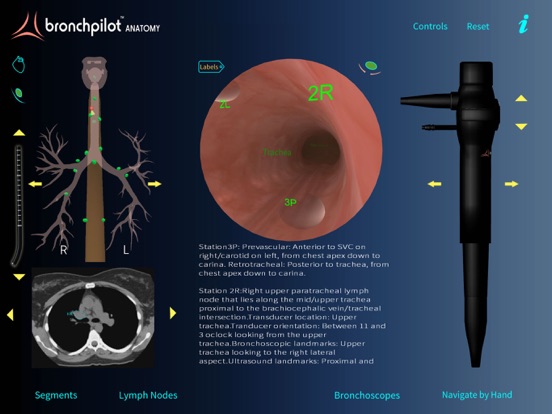 Screenshot #4 pour BronchPilot ANATOMY