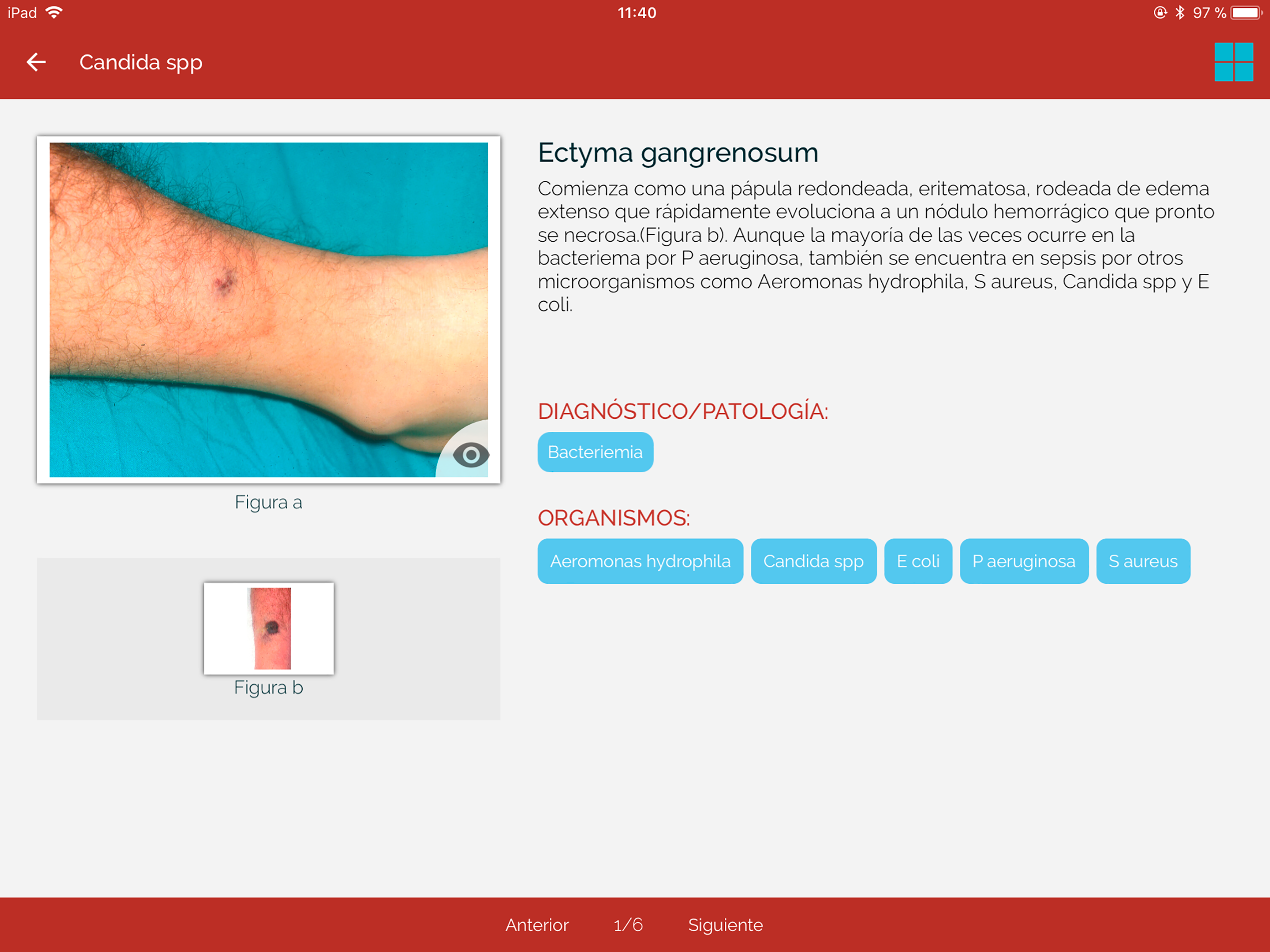 Dicc. Enfermedades infecciosas