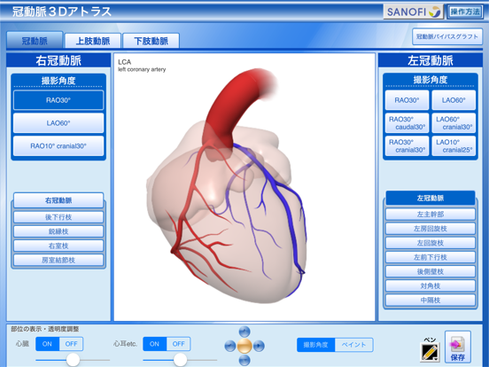 冠動脈3Dアトラスのおすすめ画像2