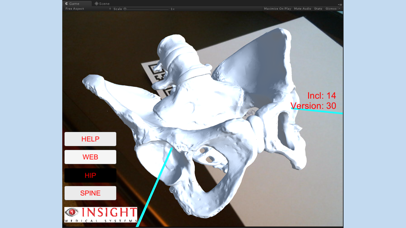 Insight Medical AR screenshot 2