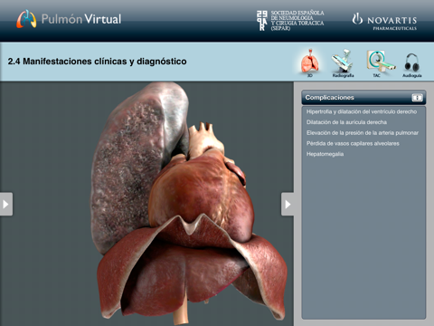 M2: Pulmón Virtual – EPOC screenshot 3