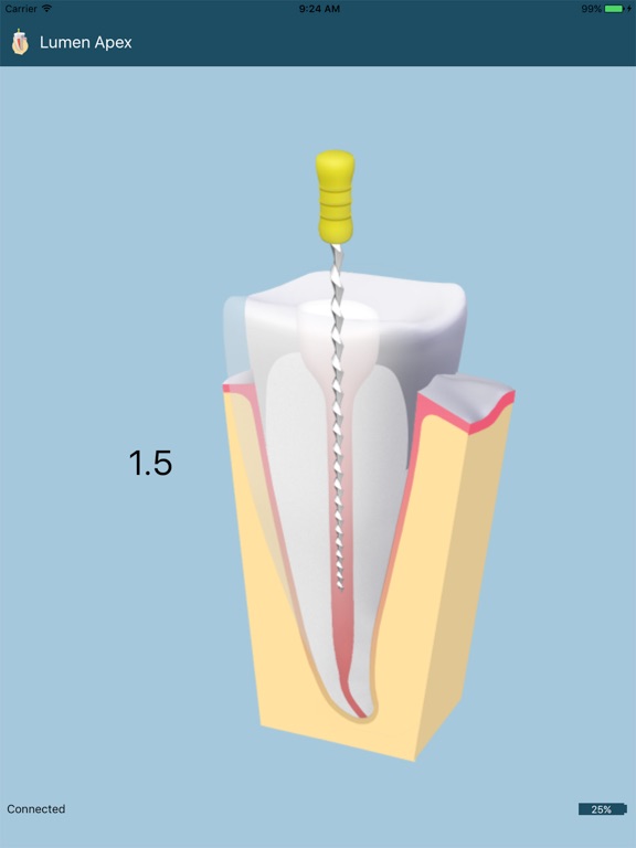 Screenshot #5 pour Lumen Apex