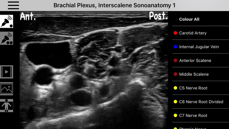 AnSo Anaesthesia Sonoanatomy