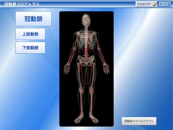 冠動脈3Dアトラスのおすすめ画像1