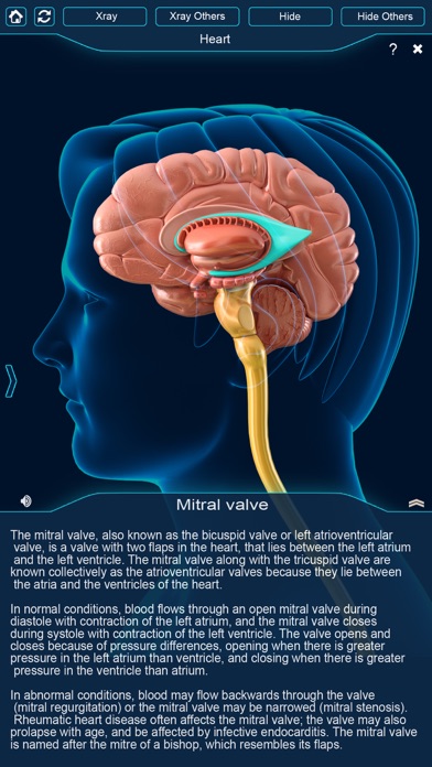 My Brain Anatomy screenshot 3