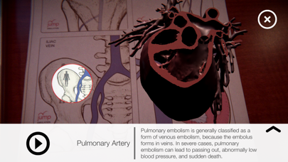 Screenshot #1 pour AR Anatomy by Jump Simulation