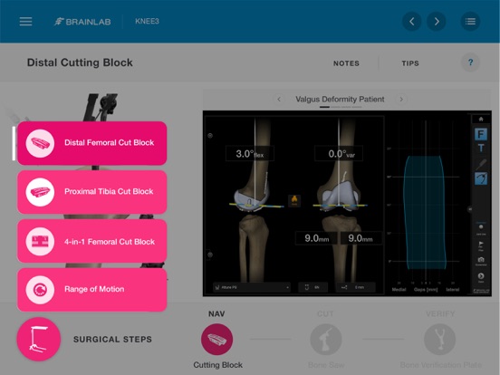 Screenshot #6 pour Brainlab KNEE3