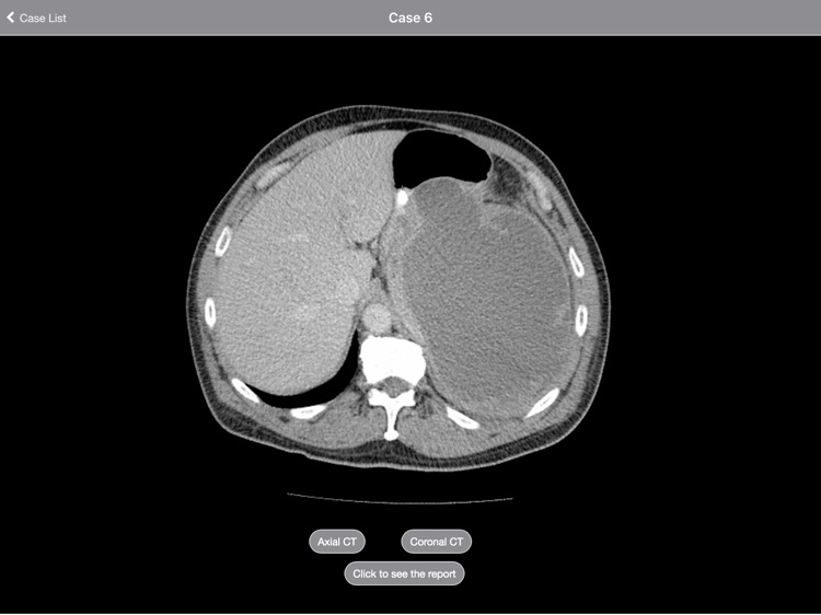Radiology 2.0: Cases from the End of the World