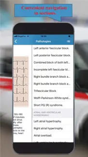 ecg: interpritation and tests. problems & solutions and troubleshooting guide - 2