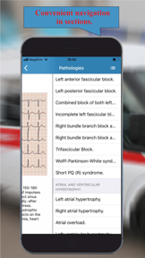 ECG: Interpritation and Tests. screenshot