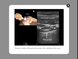 Game screenshot Trauma Ultrasound eBook mod apk