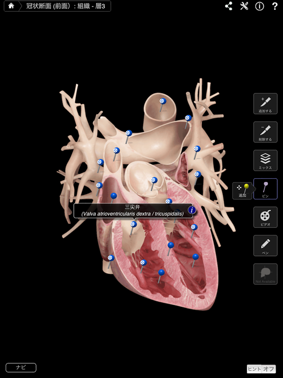 Heart Pro IIIのおすすめ画像2