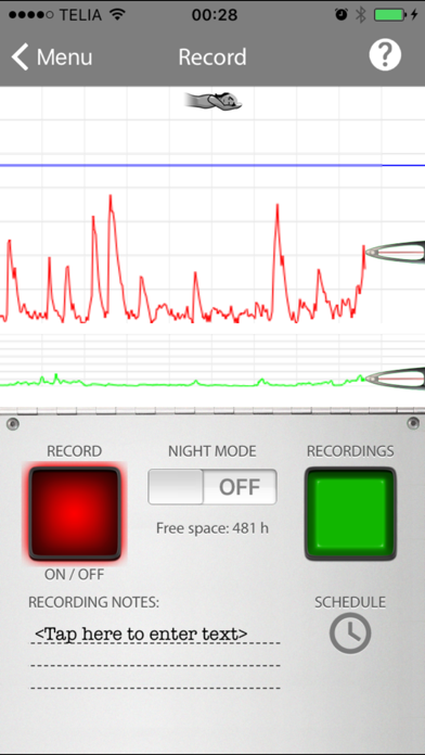 SnoreMonitorSleepLabのおすすめ画像2