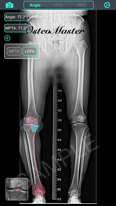 OsteoMaster Screenshot