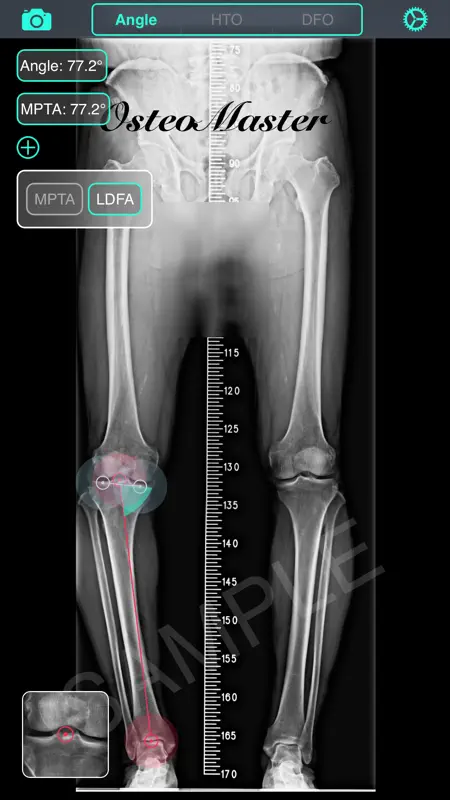 OsteoMaster screenshot 3 of 5