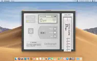 Cardiograph iphone bilder 0