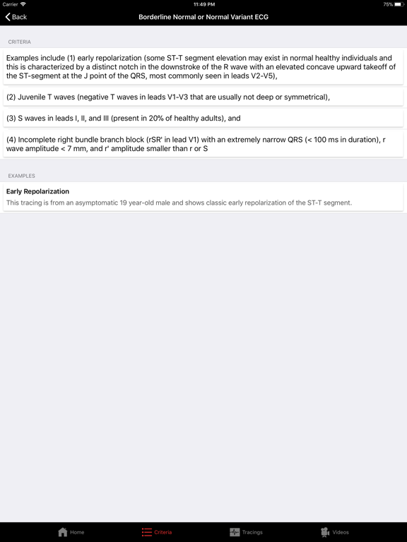 Screenshot #4 pour ECGsource