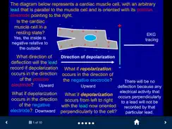 EKG - SecondLook iPad image 2