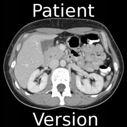 iAnatomy for Patients