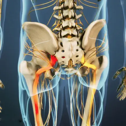 Sciatic Pain Relief Cheats