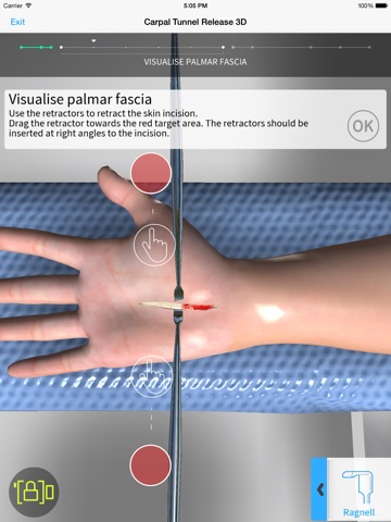 Touch Surgery: Surgical Videos screenshot 2