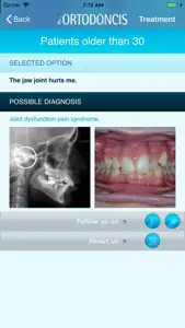 iOrtodoncis screenshot #4 for iPhone
